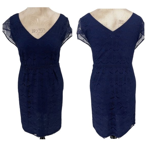 Fossil Penny Lace Dress M Bohemian Cap Sleeve V-Neck Elastic Waist Scallop Navy - Picture 2 of 11